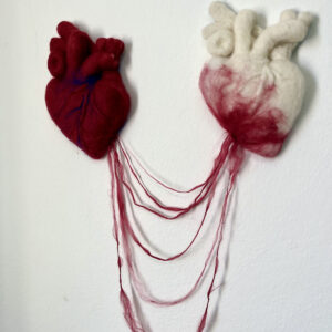 140_Snežana Crnoglavac Tijosavljević_tranfuzija snage_1