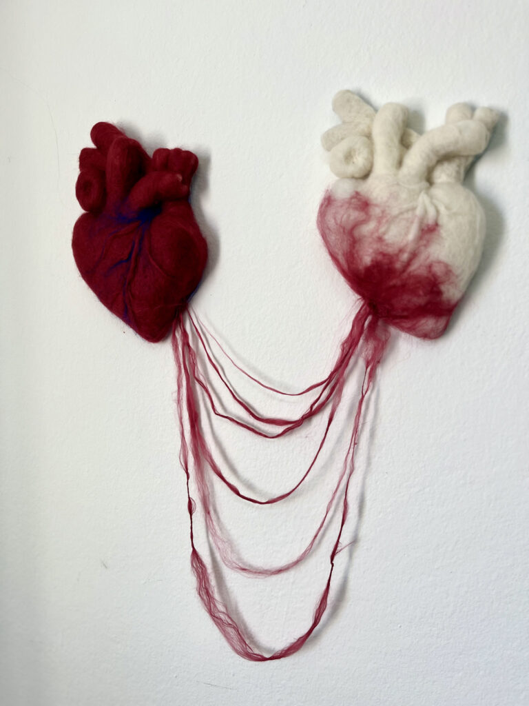 140_Snežana Crnoglavac Tijosavljević_tranfuzija snage_1